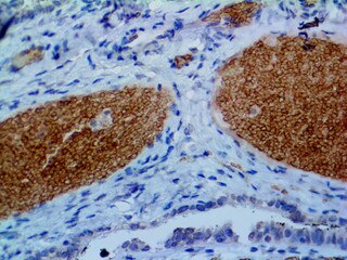 IHC of Spectrin on an FFPE Fallopian Tube Tissue
